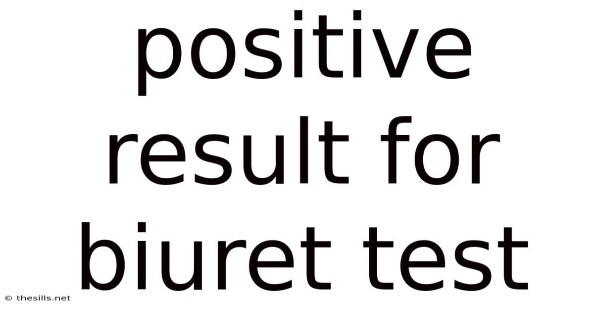 Positive Result For Biuret Test